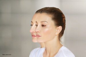 Najbolje metode za korekciju nosa